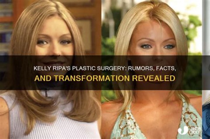 Kelly Ripa's Plastic Surgery Journey Revealed