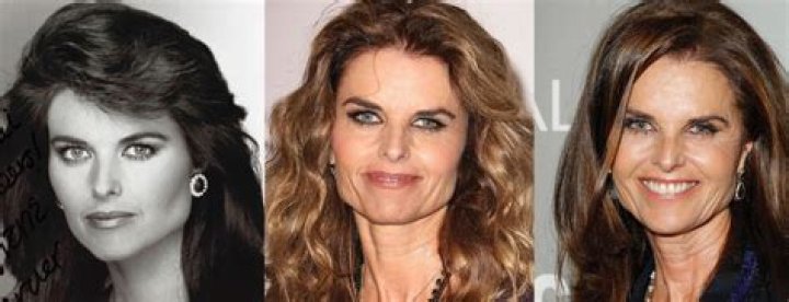 Maria Shriver's Plastic Surgery Journey: Unveiling The Truth