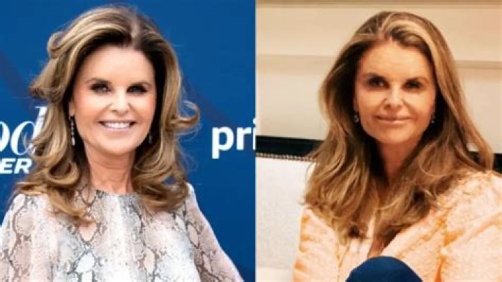 Unveiling Maria Shriver's Plastic Surgery Journey: Insider Secrets Revealed