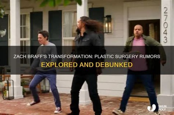 Unveiling The Secrets Of Zach Braff's Transformation: Insights Into Plastic Surgery