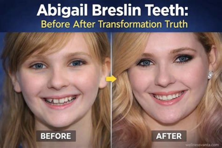Unveiling The Truths Behind Abigail Breslin's 